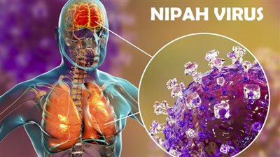 فيروس نيباه القاتل يطرق أبواب العالم… هل مصر التالية؟