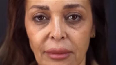 رجعت شباب.. داليا البحيري تكشف عن كواليس إجرائها عملية تجميل