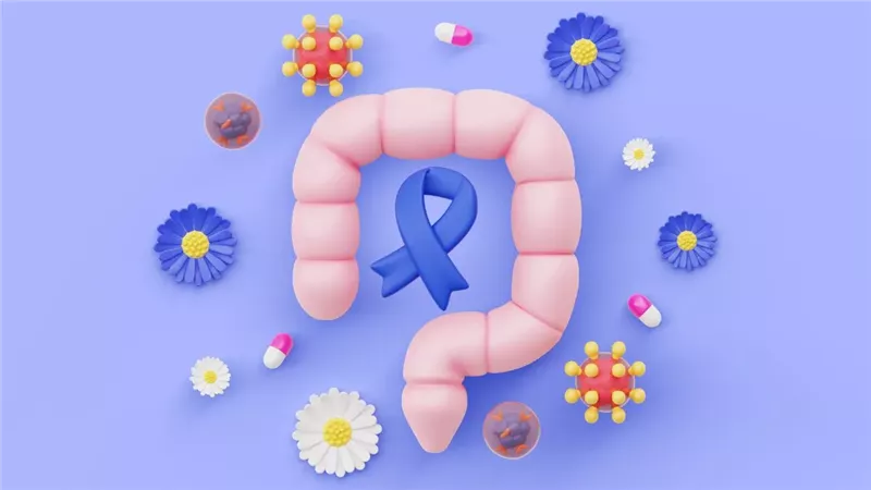 سرطان القولون 