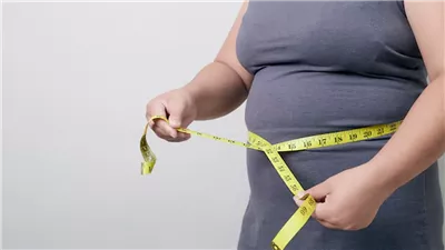 دراسة جديدة تكشف: السمنة تزيد خطر الوفاة بسبب الأمراض المعدية بنسبة 70%