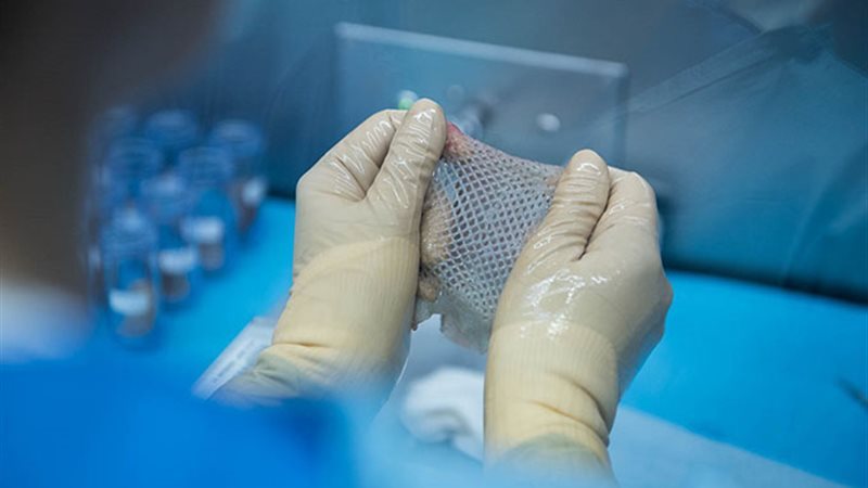 التبرع بالجلود