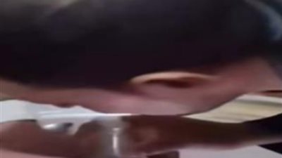 «أسنان البحيرة» تحذر من علاج تسوس الأسنان بالدخان بعد تداول فيديو مثير للجدل