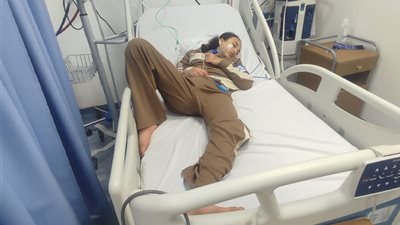 حالتها خطيرة.. تشكيل فريق طبي لمتابعة حالة طفلة البالونة