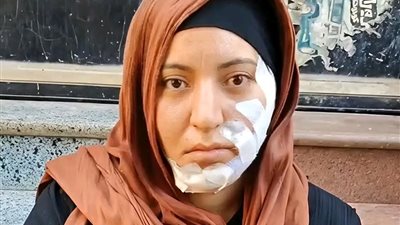 رفضت إشراكه في جمعية فاعتدى عليّ.. سمر تروي تفاصيل واقعة طعنها بالشرقية