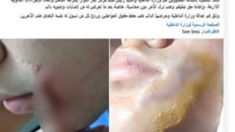 الواقعة 