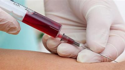 7 رسائل خفية يرسلها جسمك تكشف حاجتك لإجراء تحاليل طبية فورية