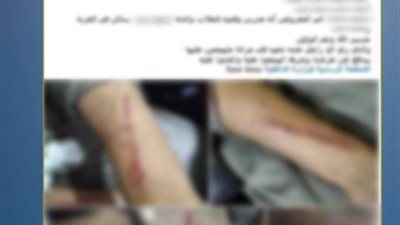 ضبط شخص وزوجته وآخرين لاتهامهم بالتعدي على شقيقه بسبب خلافات الميراث بالشرقية