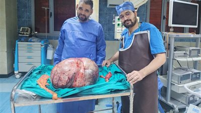 بمهارة فريق طبي مصري.. استئصال ورم مبيضي عملاق يزن 24 كيلو بالمنيا