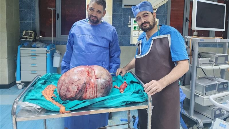 مستشفيات جامعة المنيا