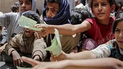 تحت مقصلة الجوع.. 18 مليون يمني يواجهون انعدام الأمن الغذائي