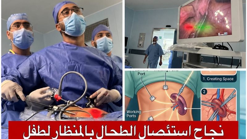 إنجاز طبي جديد بجامعة