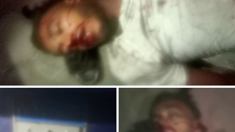 صورة الحادث 
