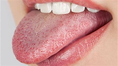 من الماء إلى السكريات.. اختيارات غذائية تدعم صحة اللسان وأخرى تضر بصحة الفم